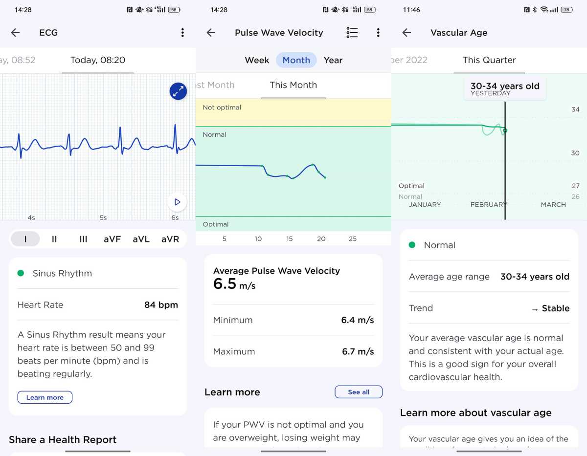 Withings Health Mate ECG and pulse wave velocity