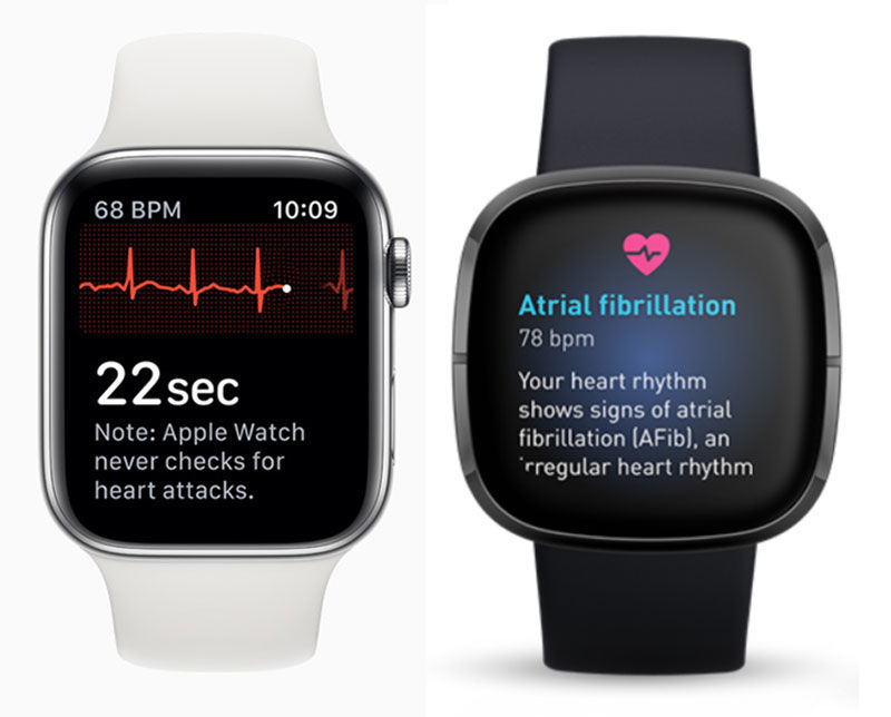ECG App Apple Watch and Fitbit